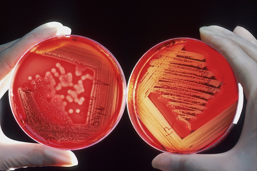 Photo bacteria contamination