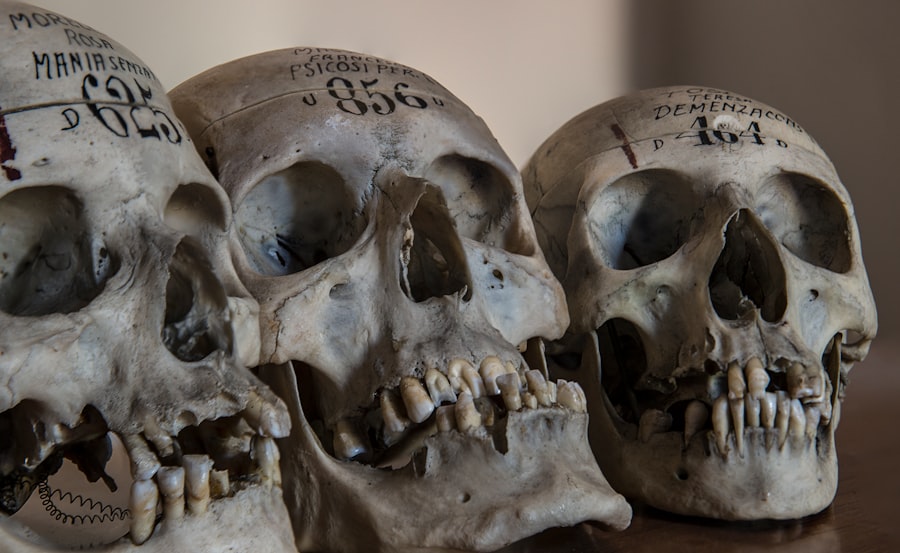 Photo elongated skulls