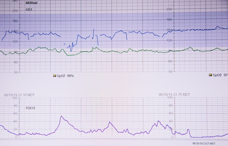 Photo geophysical stress indicators