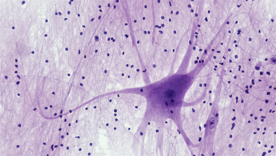 Photo amygdala