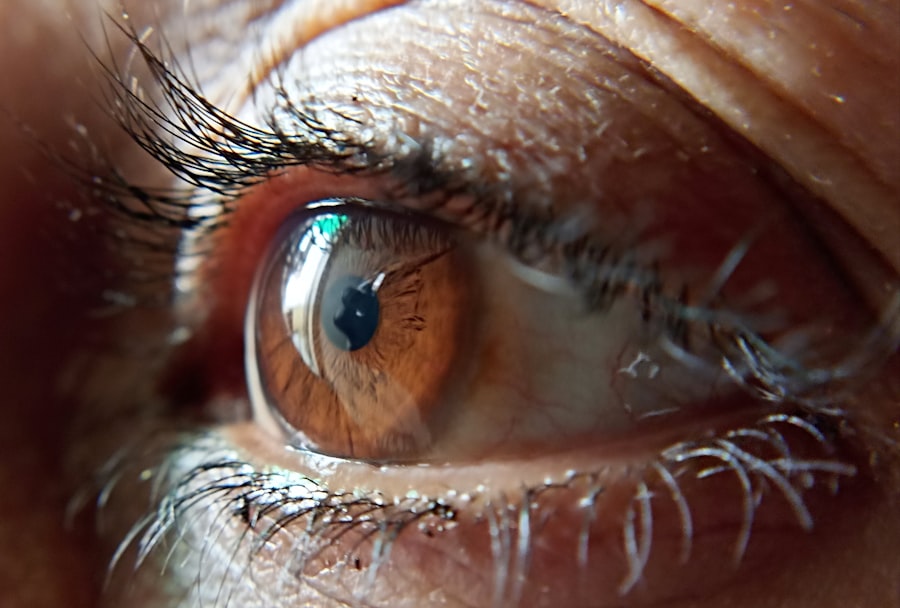 pupillary light reflex