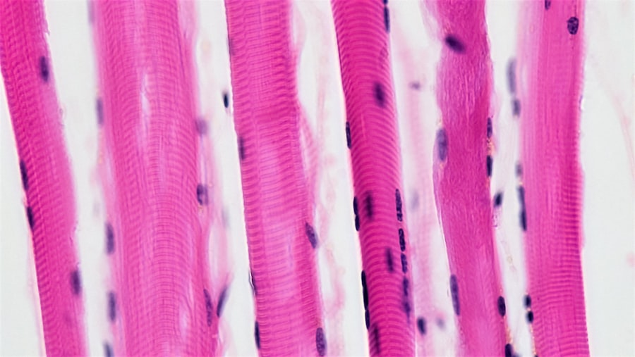 Photo chromatography