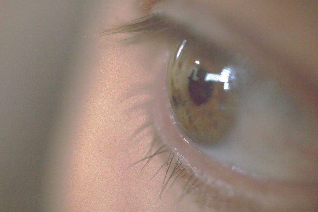 Photo observation