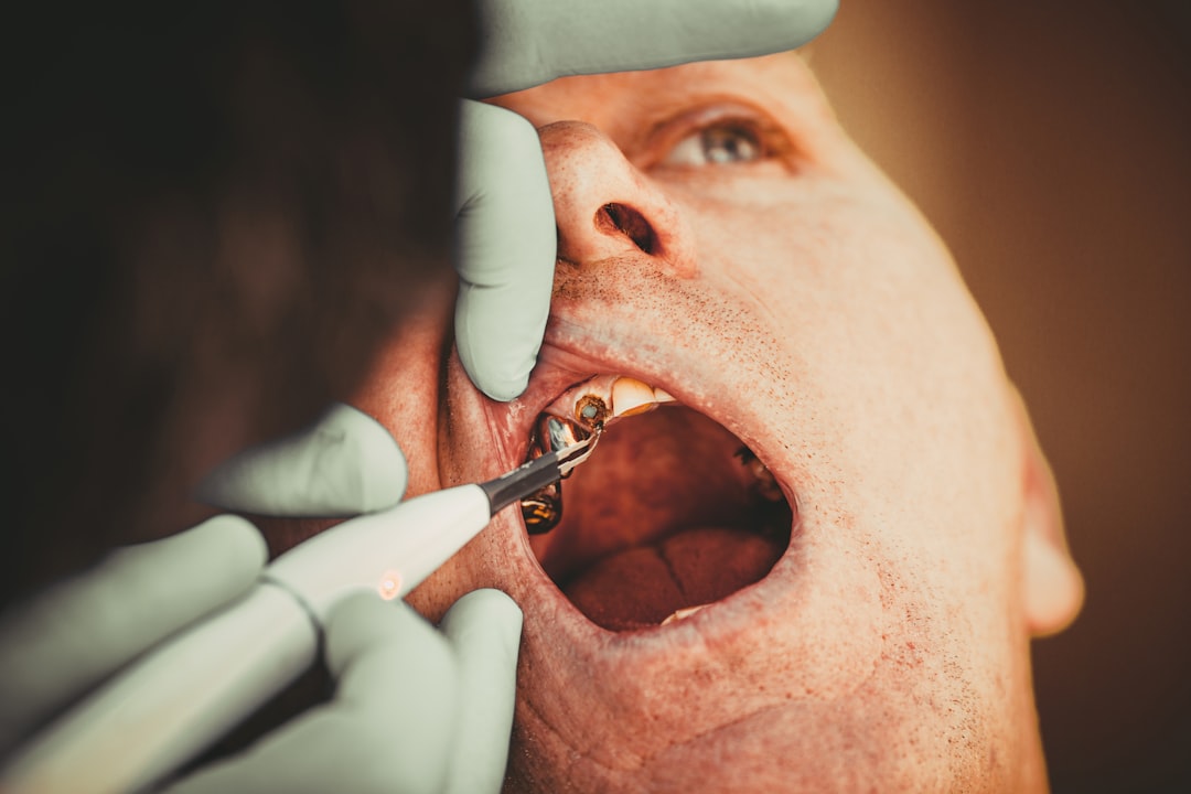 Photo dental surgery experience